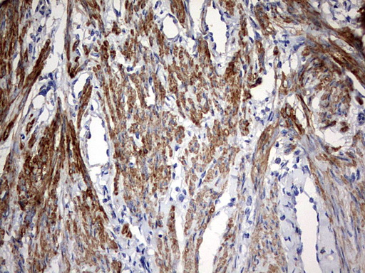 Immunohistochemical staining of paraffin-embedded Human endometrium tissue within the normal limits using anti-KLHL12 mouse monoclonal antibody
