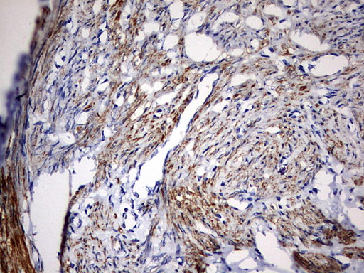 m08568 anti c3ip1 klhl12 mouse monoclonal antibody clone id oti4e1 ihc testing 4
