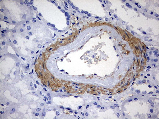 m08568 anti c3ip1 klhl12 mouse monoclonal antibody clone id oti4e1 ihc testing 5