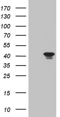 HEK293T cells were transfected with the pCMV6-ENTRY control (Left lane) or pCMV6-ENTRY CABLES1 (Right lane) cDNA for 48 hrs and lysed