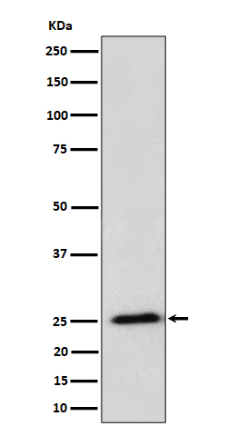 Western blot analysis of RPL10A expression in HeLa cell lysate.