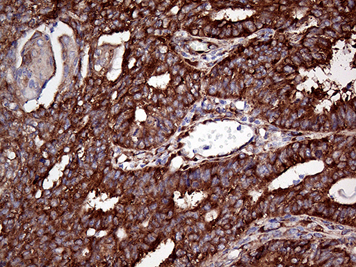 m08606 anti rpl10a mouse monoclonal antibody clone id oti4b2 ihc testing 4