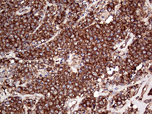 m08606 anti rpl10a mouse monoclonal antibody clone id oti4b2 ihc testing 5