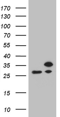 HEK293T cells were transfected with the pCMV6-ENTRY control (Left lane) or pCMV6-ENTRY RPL10A (Right lane) cDNA for 48 hrs and lysed