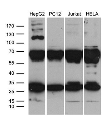 Western blot analysis of extracts (35ug) from 4 different cell lines by using anti-RPL10A monoclonal antibody (1:500)