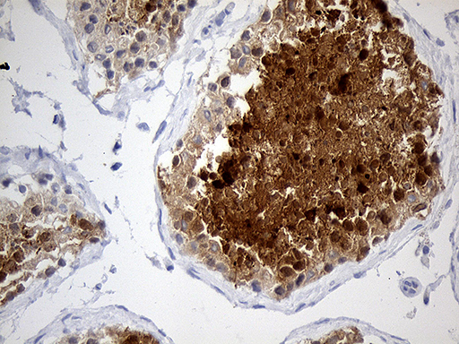 m08610 1 anti ybx2 mouse monoclonal antibody clone id oti3c12 ihc testing 3