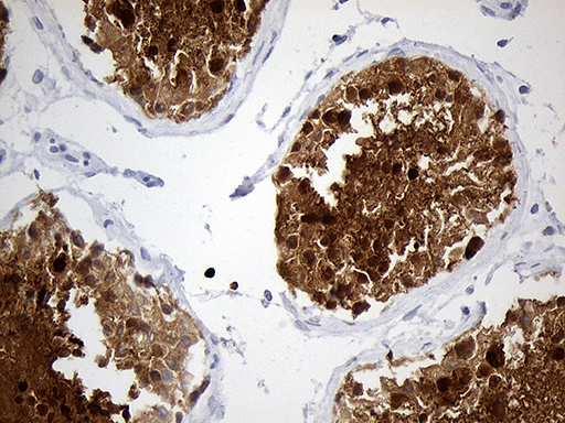 m08610 anti ybx2 mouse monoclonal antibody clone id oti3b5 ihc testing 3