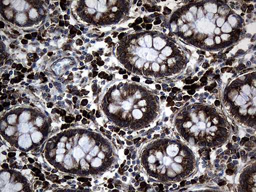 m08611 anti med28 mouse monoclonal antibody clone id oti10c8 ihc testing 3