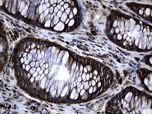 m08611 anti med28 mouse monoclonal antibody clone id oti10c8 ihc testing 4