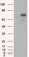 HEK293T cells were transfected with the pCMV6-ENTRY control (Left lane) or pCMV6-ENTRY C17orf28 (Right lane) cDNA for 48 hrs and lysed. Equivalent amounts of cell lysates (5 ug per lane) were separated by SDS-PAGE and immunoblotted with anti-C17orf28.
