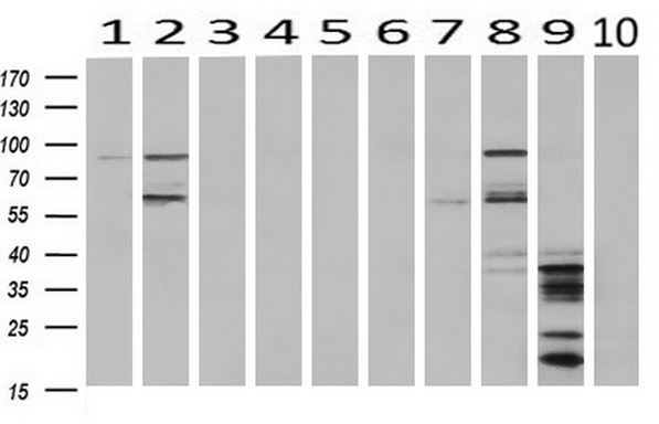 Western blot analysis of extracts (10ug) from 10 Human tissue by using anti-C17orf28 monoclonal antibody at 1:500 (1: Testis; 2: Omentum; 3: Uterus; 4: Breast; 5: Brain; 6: Liver; 7: Ovary; 8: Thyroid gland; 9: colon;10: spleen). Western blot analysis of extracts (10ug) from 10 Human tissue by using anti-C17orf28 monoclonal antibody at 1:500 (1: Testis; 2: Omentum; 3: Uterus; 4: Breast; 5: Brain; 6: Liver; 7: Ovary; 8: Thyroid gland; 9: colon;10: spleen).