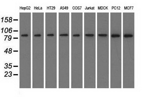 Western blot analysis of extracts (35ug) from 9 different cell lines by using anti-C17orf28 monoclonal antibody. Western blot analysis of extracts (35ug) from 9 different cell lines by using anti-C17orf28 monoclonal antibody.