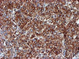 m08623 1 anti ndufb9 mouse monoclonal antibody clone id oti13h11 ihc testing 11