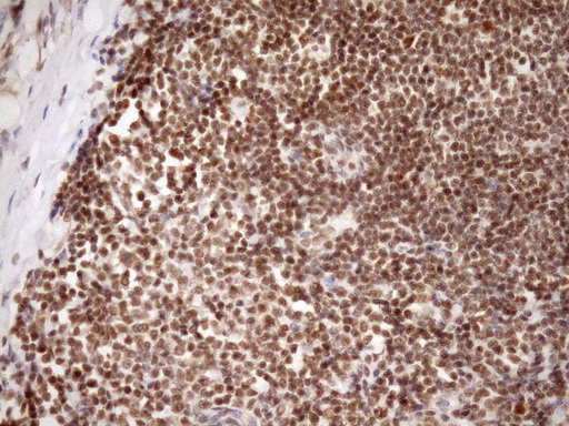 m08626 anti gcip interacting protein p29 syf2 mouse monoclonal antibody clone id oti6a5 ihc testing 10