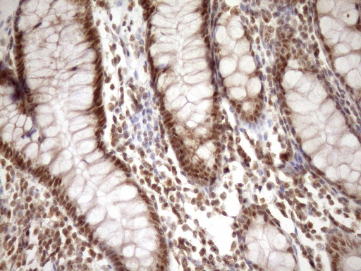 m08626 anti gcip interacting protein p29 syf2 mouse monoclonal antibody clone id oti6a5 ihc testing 11