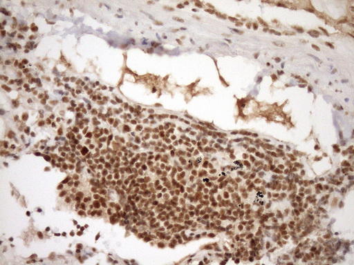 Immunohistochemical staining of paraffin-embedded Human Ovary tissue within the normal limits using anti-SYF2 mouse monoclonal antibody