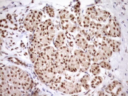 Immunohistochemical staining of paraffin-embedded Human pancreas tissue within the normal limits using anti-SYF2 mouse monoclonal antibody