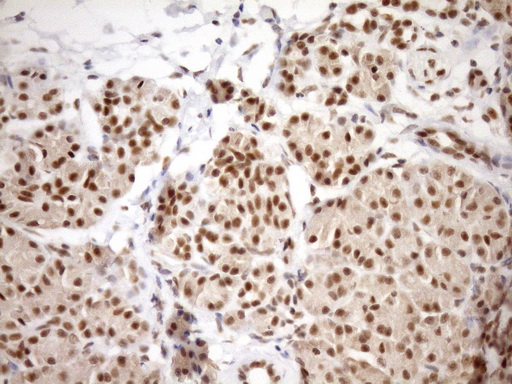 m08626 anti gcip interacting protein p29 syf2 mouse monoclonal antibody clone id oti6a5 ihc testing 5