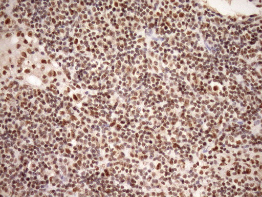 m08626 anti gcip interacting protein p29 syf2 mouse monoclonal antibody clone id oti6a5 ihc testing 7