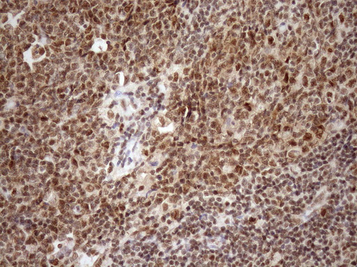 m08626 anti gcip interacting protein p29 syf2 mouse monoclonal antibody clone id oti6a5 ihc testing 8