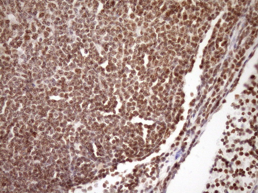 m08626 anti gcip interacting protein p29 syf2 mouse monoclonal antibody clone id oti6a5 ihc testing 9