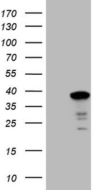 HEK293T cells were transfected with the pCMV6-ENTRY control (Left lane) or pCMV6-ENTRY SYF2 (Right lane) cDNA for 48 hrs and lysed