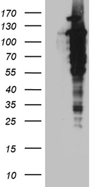 HEK293T cells were transfected with the pCMV6-ENTRY control (Left lane) or pCMV6-ENTRY UBA7 (Right lane) cDNA for 48 hrs and lysed