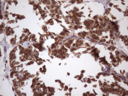 m08638 anti ndufb11 mouse monoclonal antibody clone id oti9c5 ihc testing 4