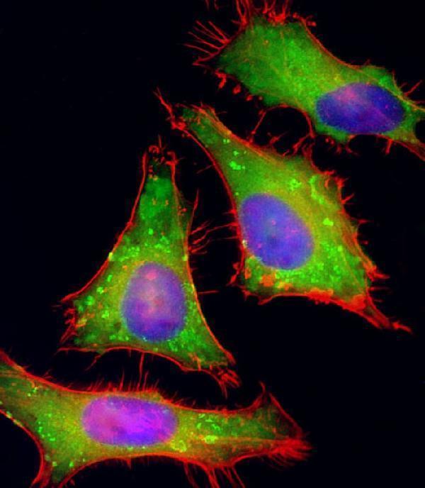 m08640 anti pgap1 antibody n term if testing 1