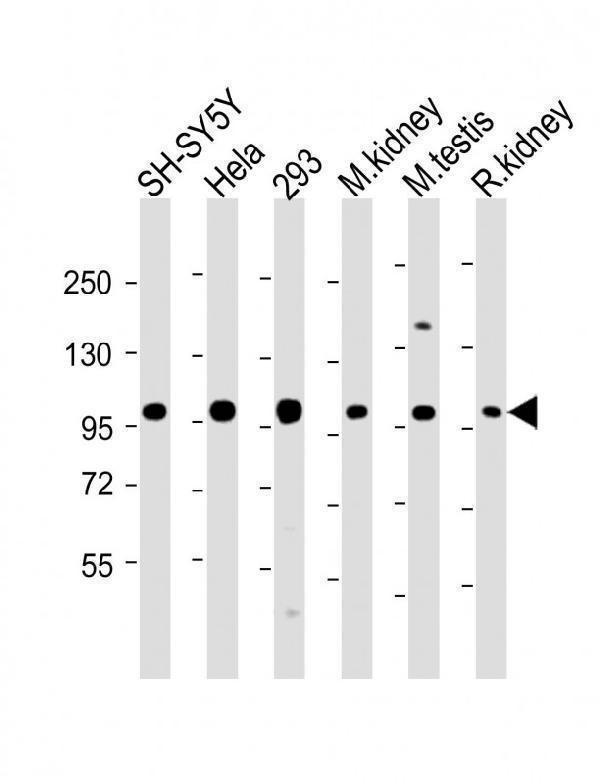m08640 anti pgap1 antibody n term wb testing 2