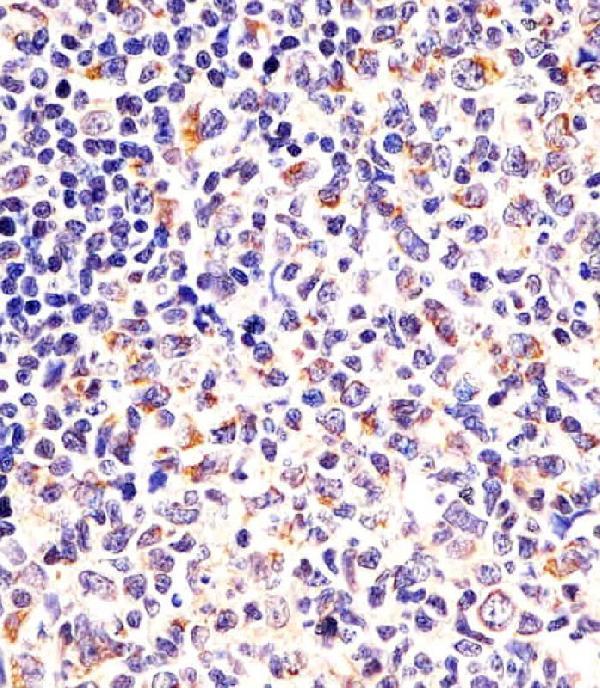 M08644-1 staining DPYSL5 in human tonsil sections by Immunohistochemistry (IHC-P -paraformaldehyde-fixed, paraffin-embedded sections)