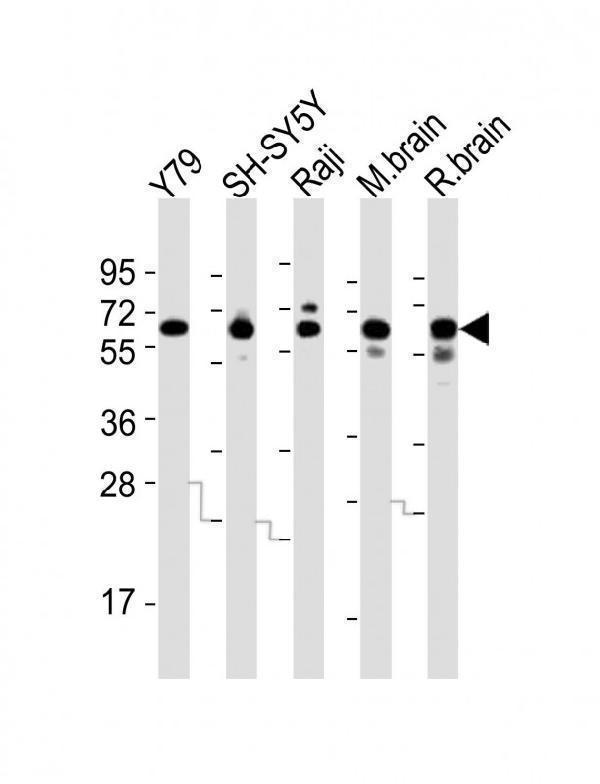 All lanes : Anti-DPYSL5 Antibody (C-term) at 1:2000 dilutionLane 1: Y79 whole cell lysatesLane 2: SH-SY5Y whole cell lysatesLane 3: Raji whole cell lysatesLane 4: mouse brain lysatesLane 5: rat brain lysatesLysates/proteins at 20 µg per lane