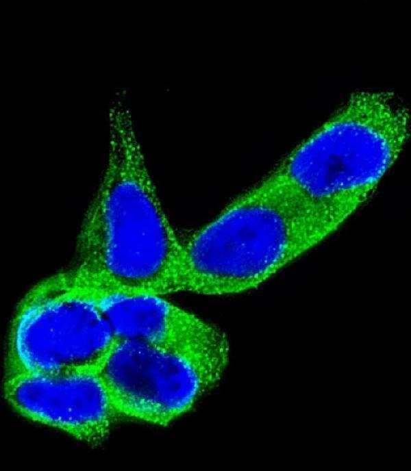 m08644 2 anti dpysl5 antibody if testing 1