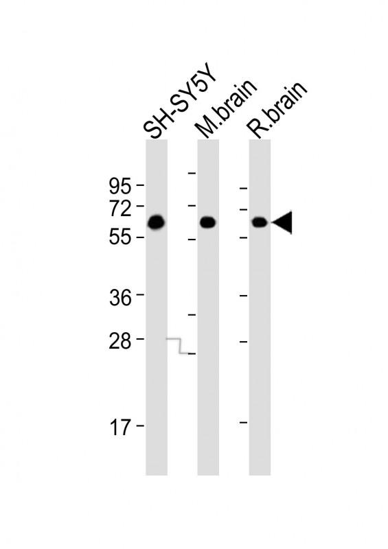 m08644 2 anti dpysl5 antibody wb testing 2