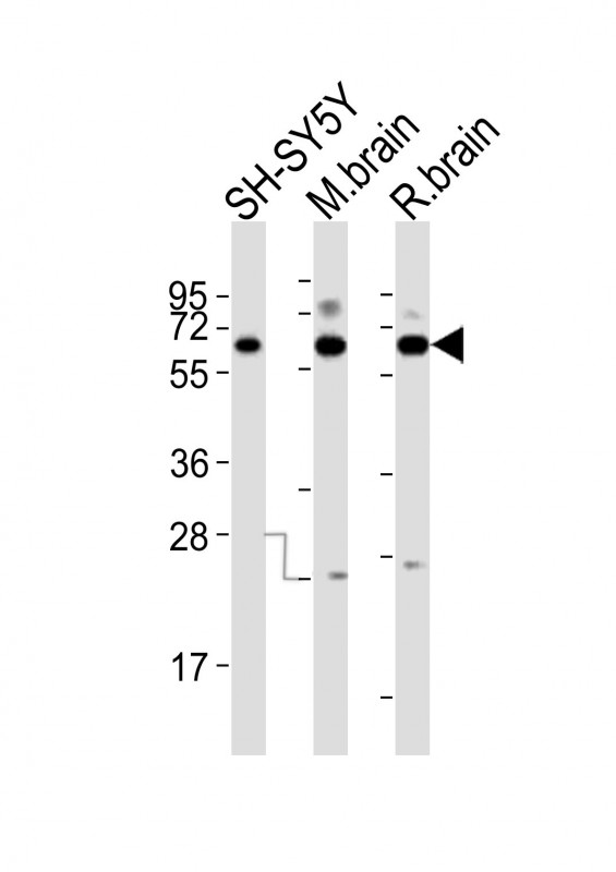 All lanes : Anti-DPYSL5 Antibody (C-term) at 1:2000 dilutionLane 1: SH-SY5Y whole cell lysatesLane 2: mouse brain lysatesLane 3: rat brain lysatesLysates/proteins at 20 µg per lane
