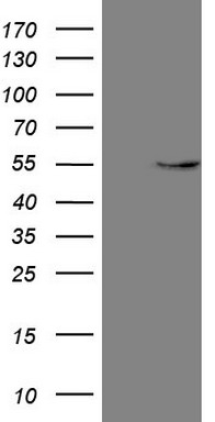 HEK293T cells were transfected with the pCMV6-ENTRY control (Left lane) or pCMV6-ENTRY GAS8 (Right lane) cDNA for 48 hrs and lysed
