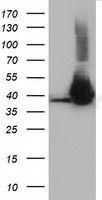HEK293T cells were transfected with the pCMV6-ENTRY control (Left lane) or pCMV6-ENTRY HIBCH (Right lane) cDNA for 48 hrs and lysed