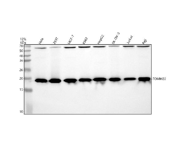 Figure 1. Western blot analysis of CLIC4 using anti-CLIC4 antibody (M08668). Electrophoresis was performed on a 5-20% SDS-PAGE gel at 70V (Stacking gel) / 90V (Resolving gel) for 2-3 hours. The sample well of each lane was loaded with 30 ug of sample under reducing conditions. Lane 1: human Hela whole cell lysates, Lane 2: human 293T whole cell lysates, Lane 3: human MCF-7 whole cell lysates, Lane 4: human K562 whole cell lysates, Lane 5: human HepG2 whole cell lysates, Lane 6: human SK-OV-3 whole cell lysates, Lane 7: human Jurkat whole cell lysates, Lane 8: human Raji whole cell lysates. After electrophoresis, proteins were transferred to a nitrocellulose membrane at 150 mA for 50-90 minutes. Blocked the membrane with 5% non-fat milk/TBS for 1.5 hour at RT. The membrane was incubated with rabbit anti-CLIC4 antigen affinity purified monoclonal antibody (Catalog # M08668) at 1:500 overnight at 4°C, then washed with TBS-0.1%Tween 3 times with 5 minutes each and probed with a goat anti-rabbit IgG-HRP secondary antibody at a dilution of 1:500 for 1.5 hour at RT. The signal is developed using an Enhanced Chemiluminescent detection (ECL) kit (Catalog # EK1002) with Tanon 5200 system. A specific band was detected for CLIC4 at approximately 18 kDa. The expected band size for CLIC4 is at 29 kDa.