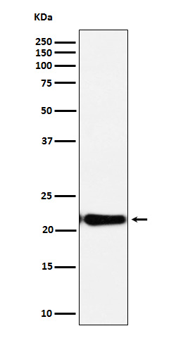 Anti-DNPH1 Rabbit Monoclonal Antibody Anti-DNPH1 Rabbit Monoclonal Antibody