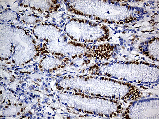 m08695 1 anti fubp3 mouse monoclonal antibody clone id oti7b6 ihc testing 1