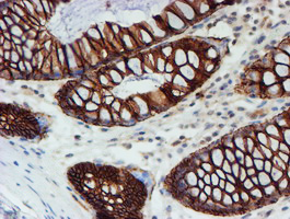 m08697 anti fxyd3 mouse monoclonal antibody clone id oti1e8 ihc testing 11