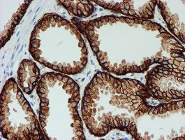 m08697 anti fxyd3 mouse monoclonal antibody clone id oti1e8 ihc testing 6
