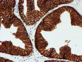 m08697 anti fxyd3 mouse monoclonal antibody clone id oti1e8 ihc testing 7