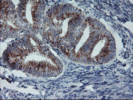m08725 1 anti coatomer subunit delta arcn1 mouse monoclonal antibody clone id oti6a6 ihc testing 4