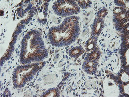 m08725 1 anti coatomer subunit delta arcn1 mouse monoclonal antibody clone id oti6a6 ihc testing 6
