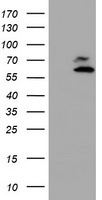 HEK293T cells were transfected with the pCMV6-ENTRY control (Left lane) or pCMV6-ENTRY ARCN1 (Right lane) cDNA for 48 hrs and lysed