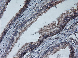 m08725 anti coatomer subunit delta arcn1 mouse monoclonal antibody clone id oti4h9 ihc testing 5