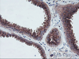 m08725 anti coatomer subunit delta arcn1 mouse monoclonal antibody clone id oti4h9 ihc testing 6