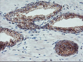 m08725 anti coatomer subunit delta arcn1 mouse monoclonal antibody clone id oti4h9 ihc testing 7
