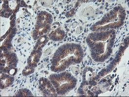 m08725 anti coatomer subunit delta arcn1 mouse monoclonal antibody clone id oti4h9 ihc testing 8